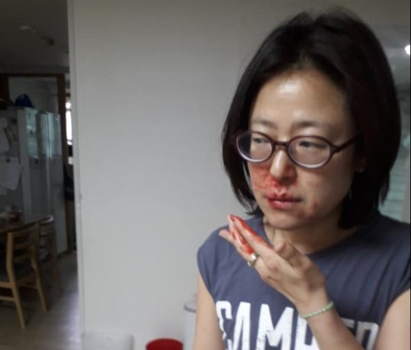 구타당한 모습의 황보승희 의원 사진